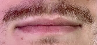 Lips
