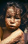 Indigenous peoples